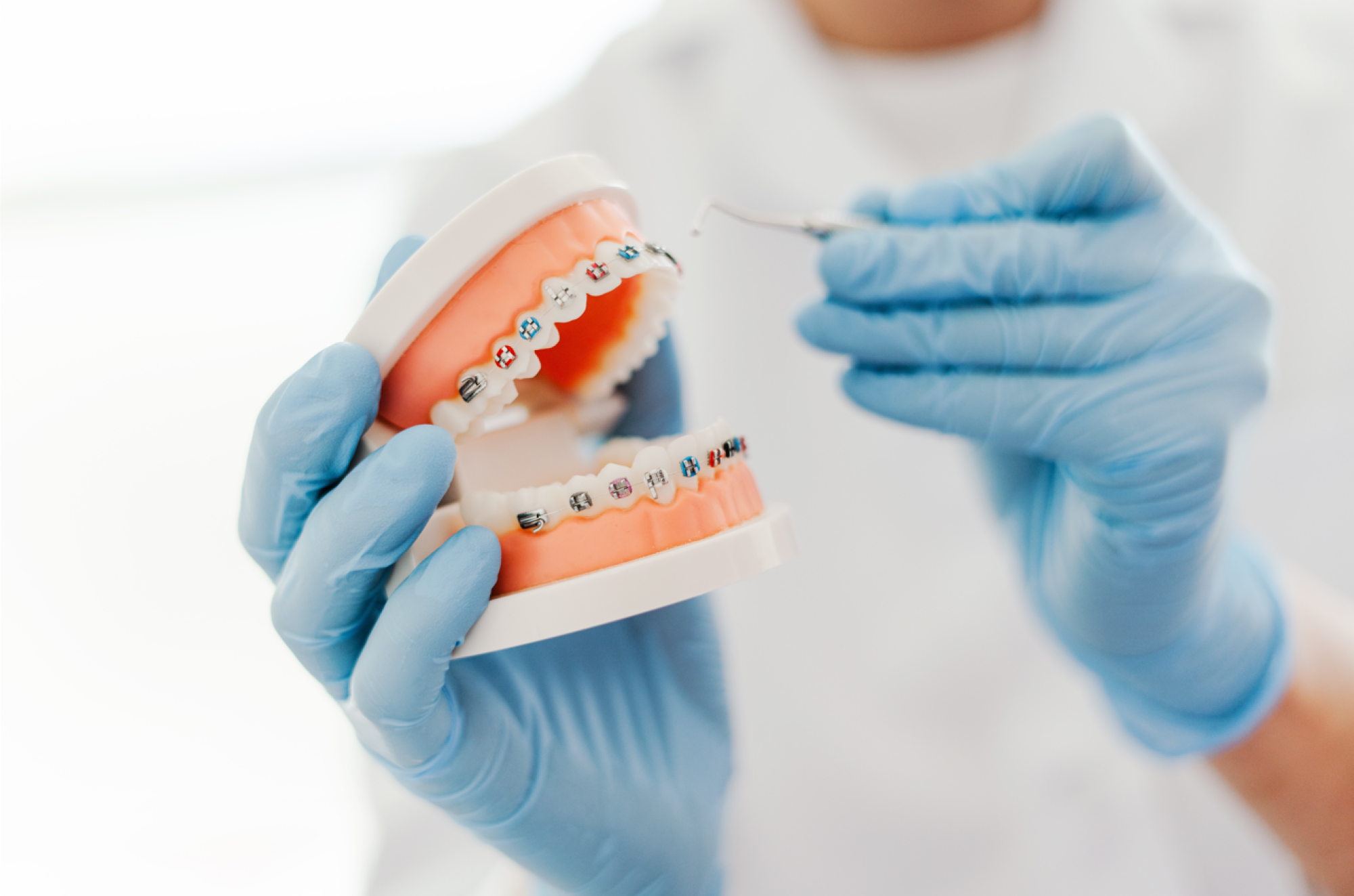 Prise en charge de l'orthodontie